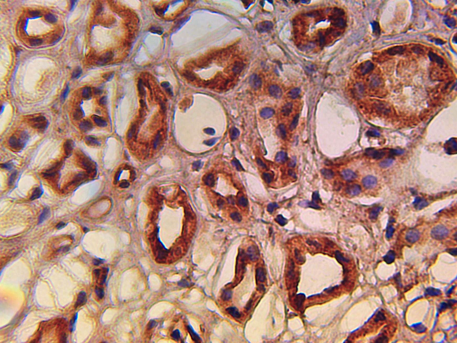 Immunohistochemical staining of normal human kidney tissue using Sirt1 antibody (Cat. No. X2739P) at 10 µg/ml and detected using anti-Rabbit HRP secondary antibody and visualized using DAB substrate and hematoxylin counterstain.